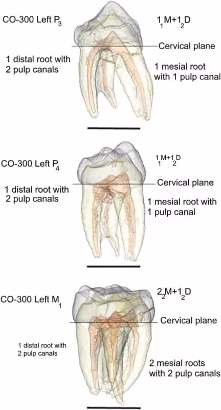 3 D Reconstruction Of The Left P3 To M1 Of CO 300, Showing The Root, Root Canal And Pulp Chamber Configurations