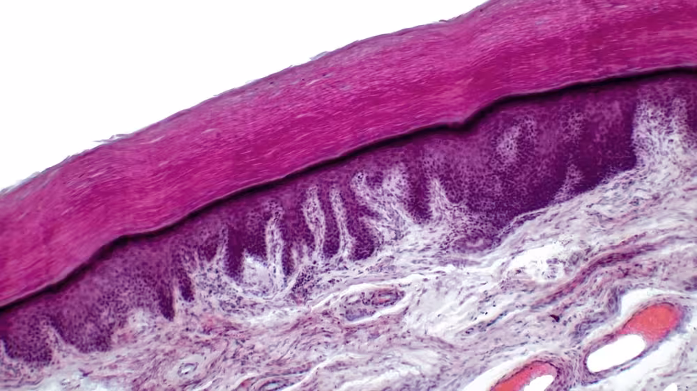 Human,skin.,light,micrograph,of,epithelial,tissue,from,the,skin.