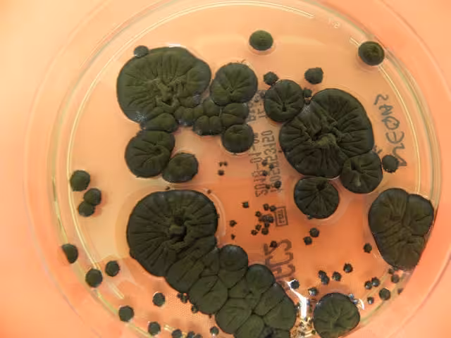 Cladosporium Sphaerospermum, Cultivated At Coimbra University Hospital Centre In Portugal