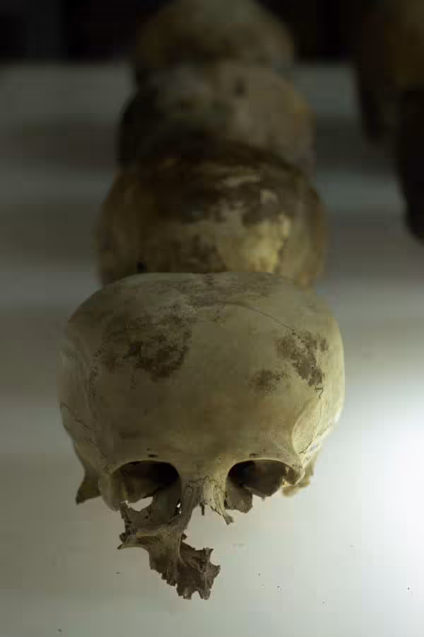 The Skulls Show A High Prevalence Of Cranial Modeling, A Common Practice In Pre Hispanic Times