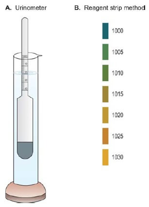 Urinometer method and Reagent strip method for measuring specific gravity of urine