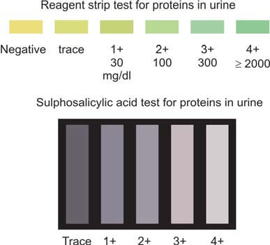 Grading of proteinuria with reagent strip test