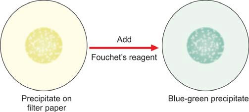 Positive Fouchets test for bilirubin in urine