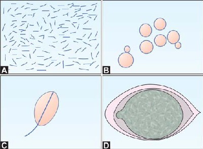 Organisms in urine