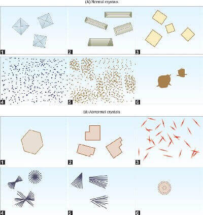 Crystals in urine