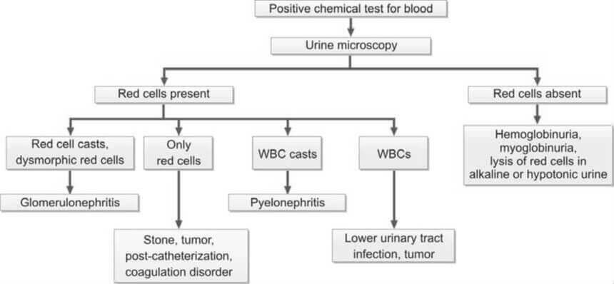 Evaluation of positive chemical test for blood in urine