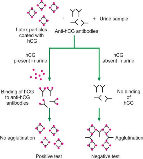 Principle of agglutination inhibition test for diagnosis of pregnancy