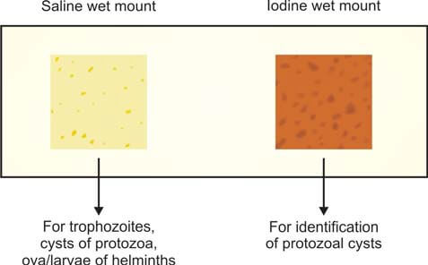Saline and iodine wet mounts of fecal sample