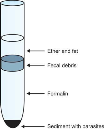 Formol ethyl acetate concentration technique