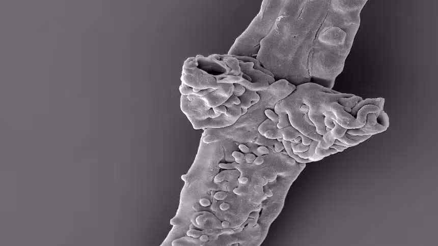 Microscopic View Of Tortotubus Protuberans. Credit Martin R. Smith.