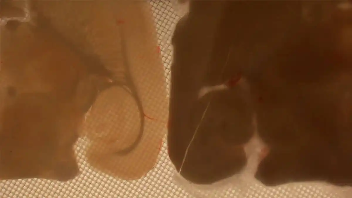 On The Left, Vitrified Tissue Is Maintained; On The Right, Ice Crystal Formation Has Caused Breakage.