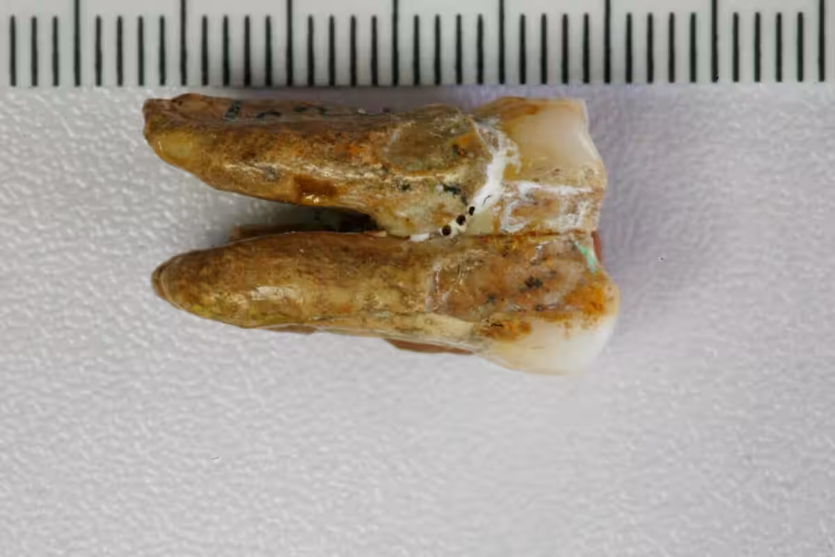 Ancient Tooth Found At The Zhoukoudian Site In China.