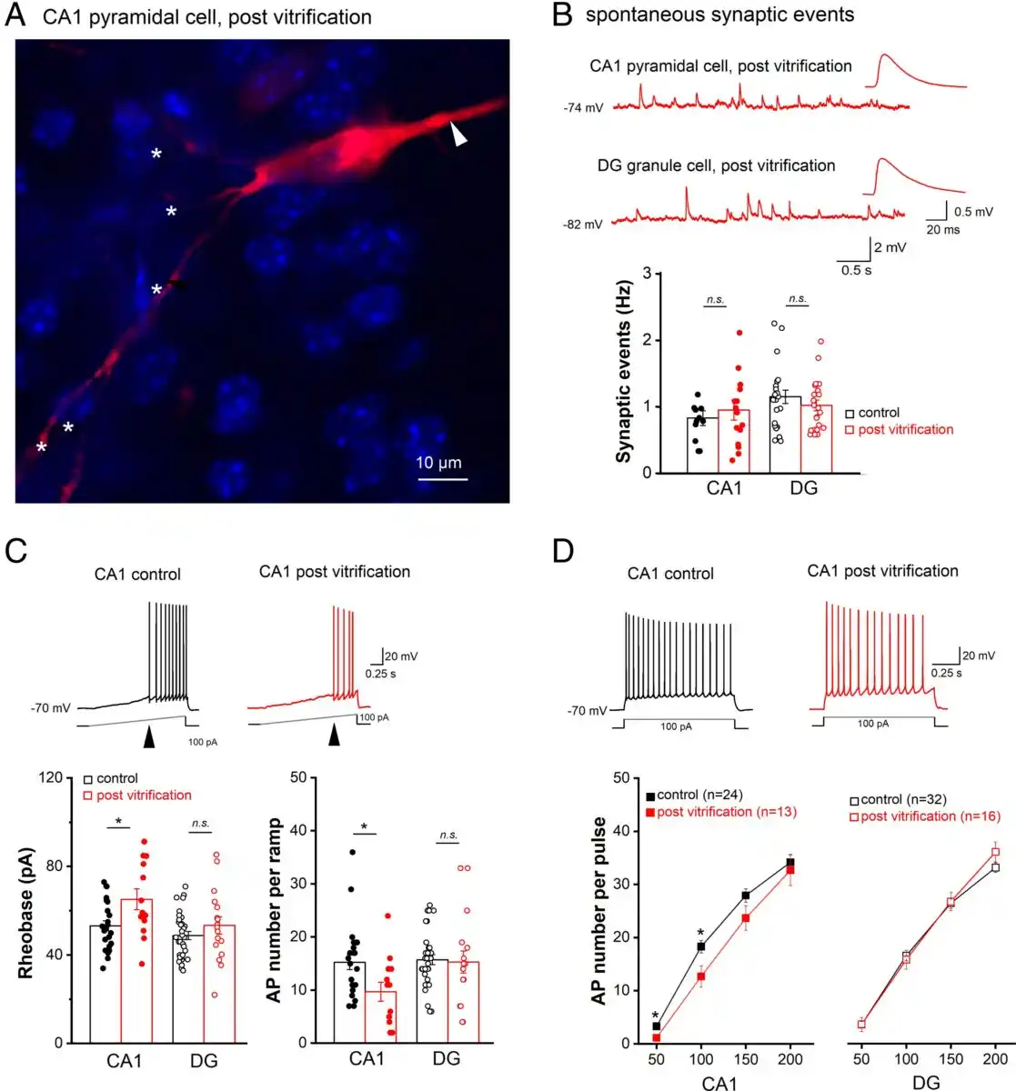 Neuronal Morphology And Firing Properties In Hippocampal Ca1 And Dg Cells Remain Intact Post Vitrification