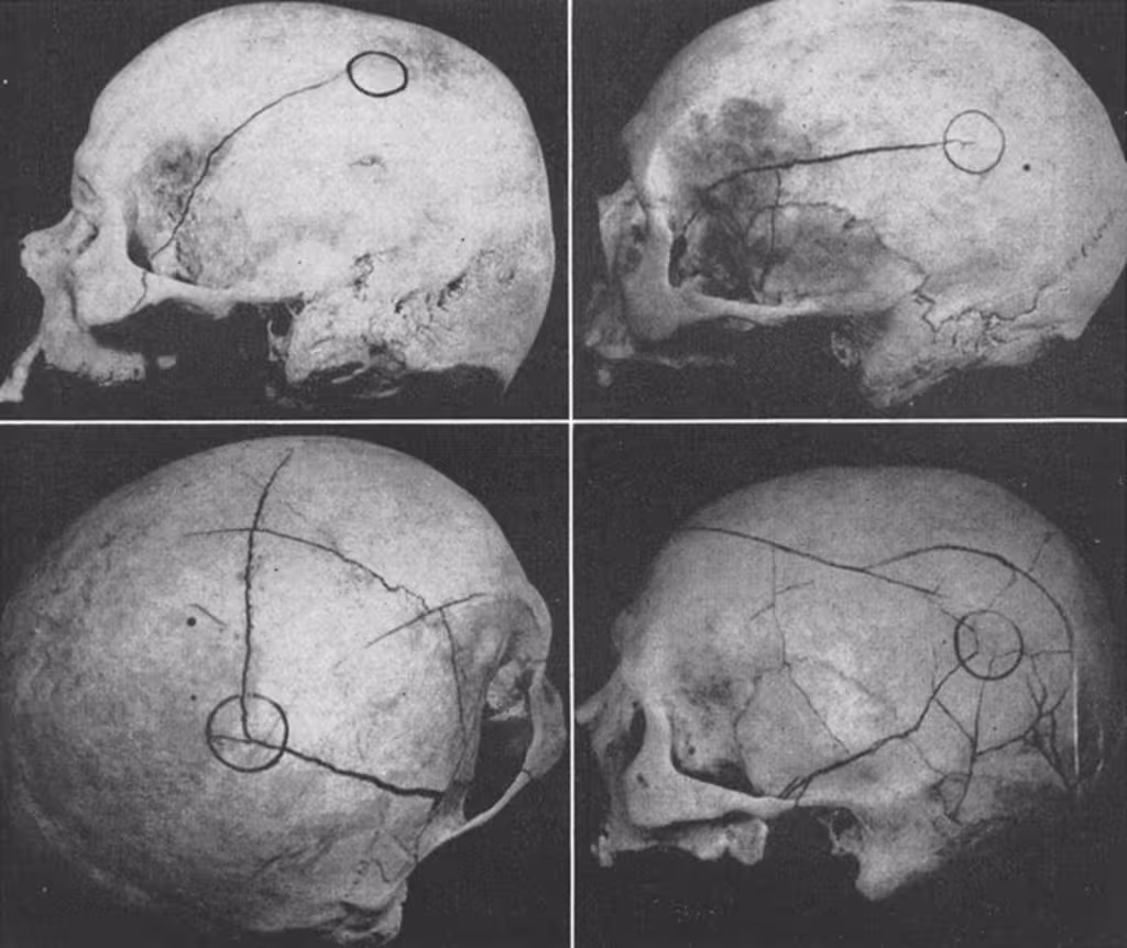 Scientists Examined 46 Ancient Skulls And Found Signs Of Violence On 18