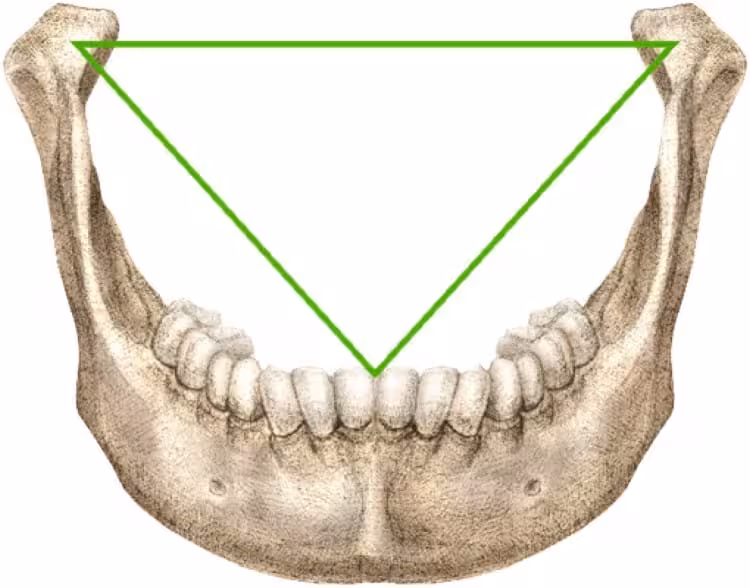 First Described In 1864, Bonwill’s Triangle Illustrates The Geometric Balance Underlying Human Jaw Movement.