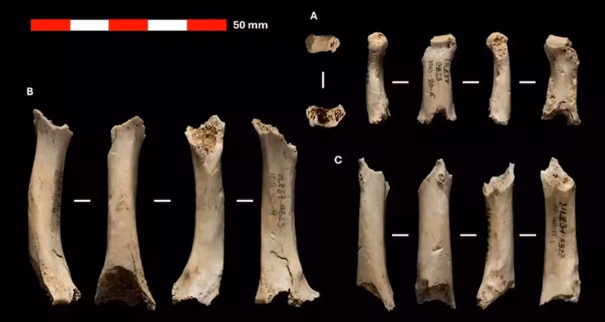 Remains Of A Neanderthal's Right Hand From Abauntz, Shown From Different Angles.
