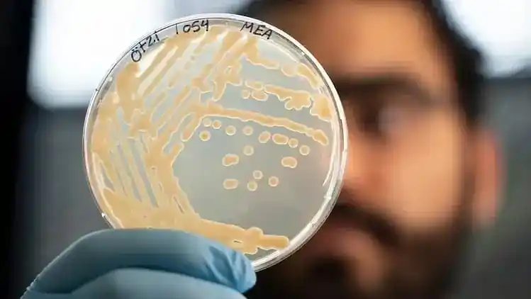Yeast Cells Cultured From Ötzi’s Stomach Under The Microscope.