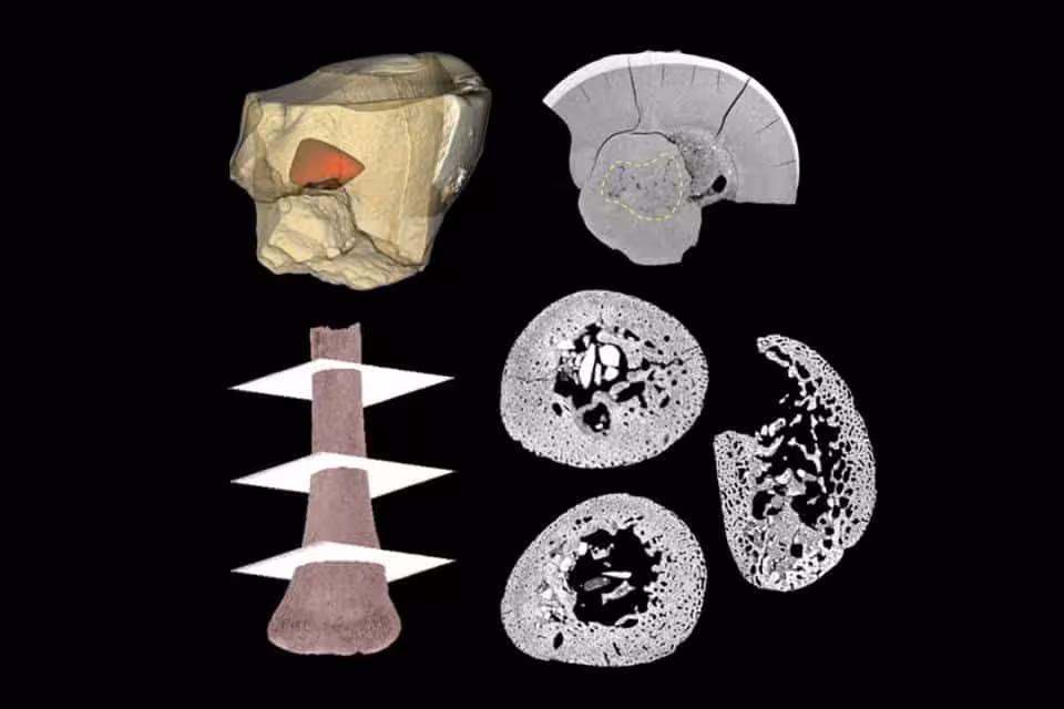 3d Reconstruction And Ct Scans Of A Neanderthal Fetal Bone.