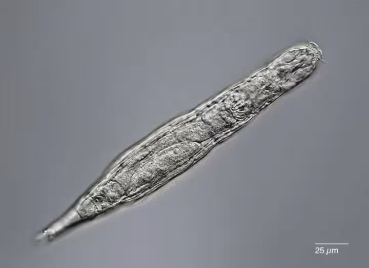 A rotifer seen under a microscope. Michael Plewka