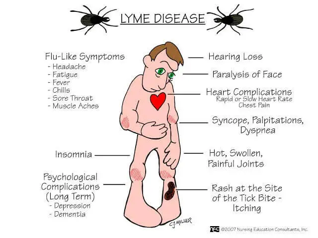 Symptoms of Lyme Disease