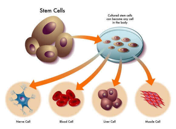 Stem Cell Remedy