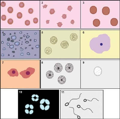 Cells in urine