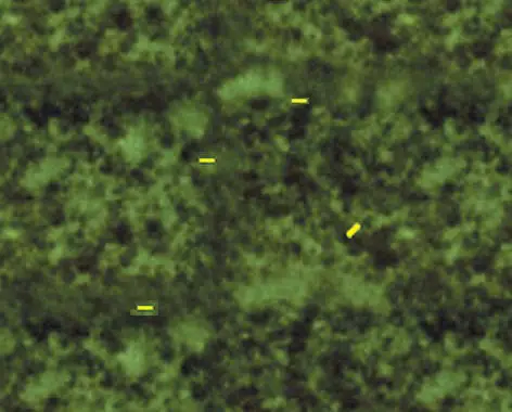 Demonstration of mycobacteria in sputum by fluorescence microscopy. Bacilli appear as yellow fluorescing rods with auramine O against dark background