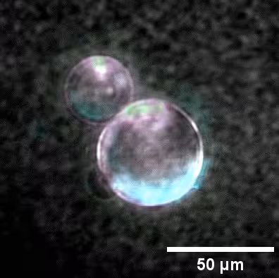 Microscopy Image Of Spudcell During Division