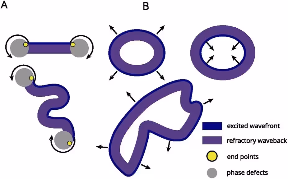 FIGURE 1: Illustrated examples of the two wave types. (A) Open waves are topologically equivalent to line segments, are attached to a phase defect (anatomical obstacles, scar tissue, or functional obstacles like refractory tissue), and are bounded by two endpoints of opposite chirality. (B) Closed waves are topologically equivalent to rings, and have no endpoints. Depending on the direction of propagation, a closed wave may expand or shrink.