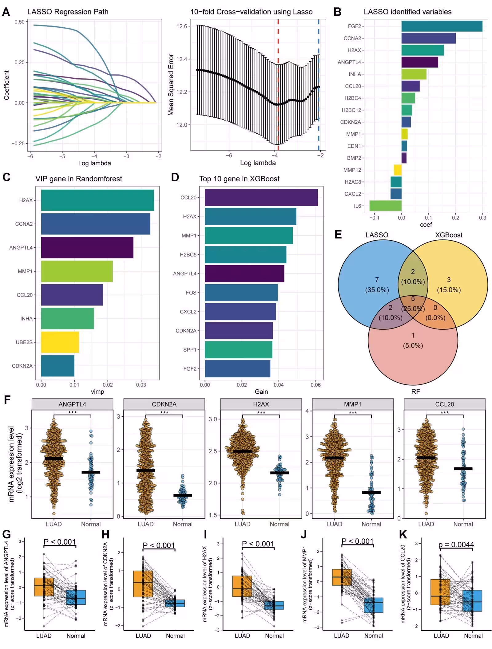 Figure 3: Identification of key senescence-associated secretory phenotype (SASP) genes linked to lung adenocarcinoma (LUAD) prognosis using machine learning algorithms. (A) Least Absolute Shrinkage and Selection Operator (LASSO) regression path and 10-fold cross-validation for identifying key SASP genes. The left panel illustrates the variation in the number of candidate genes with different penalty parameters (Lambda), while the right panel displays the 10-fold cross-validation results. The blue dashed line indicates the number of variables with non-zero regression coefficients at lambda.1se, and the red dashed line indicates the number at lambda.min. (B) Ranking of regression coefficients for variables identified by LASSO. (C) Ranking of key SASP genes based on variable importance from the Random Forest algorithm. (D) Ranking the top 10 SASP genes by importance, identified by the Extreme Gradient Boosting (XGBoost) algorithm. (E) Venn diagram showing the overlap of key SASP genes identified by