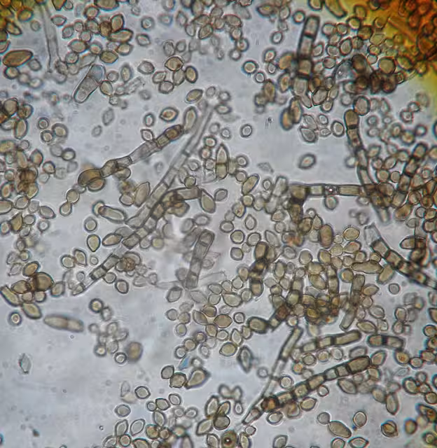 Microscopic View Of Cladosporium Sphaerospermum, Showing The Dark Pigmented Fungal Structures Associated With This Melanin Rich Species.