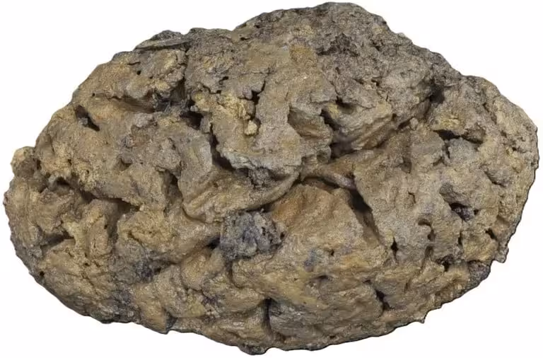 An Adult Brain Preserved In Remarkable Condition After Being Buried In A Waterlogged Grave In Bristol And Coated With Clay.
