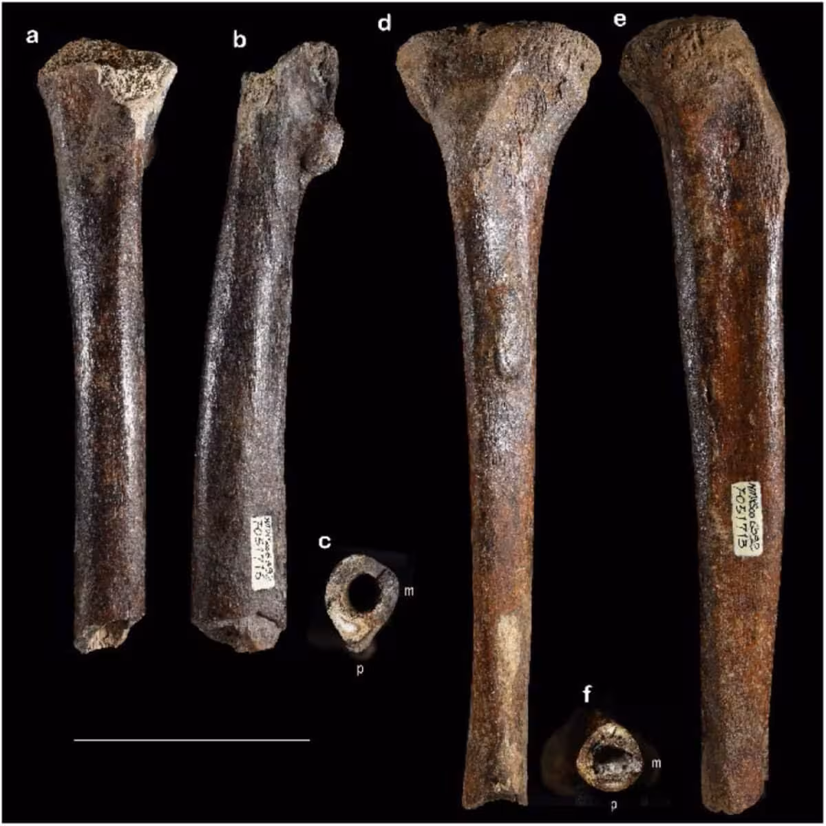 The Denisovan Femur And Tibia Known As Penghu 2 And Penghu 3