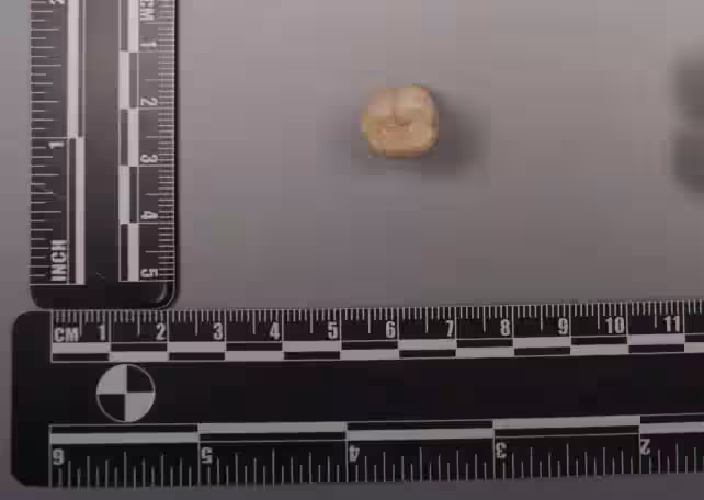 One Of The Fossil Teeth Analyzed In The Study Came From Sunjiadong.
