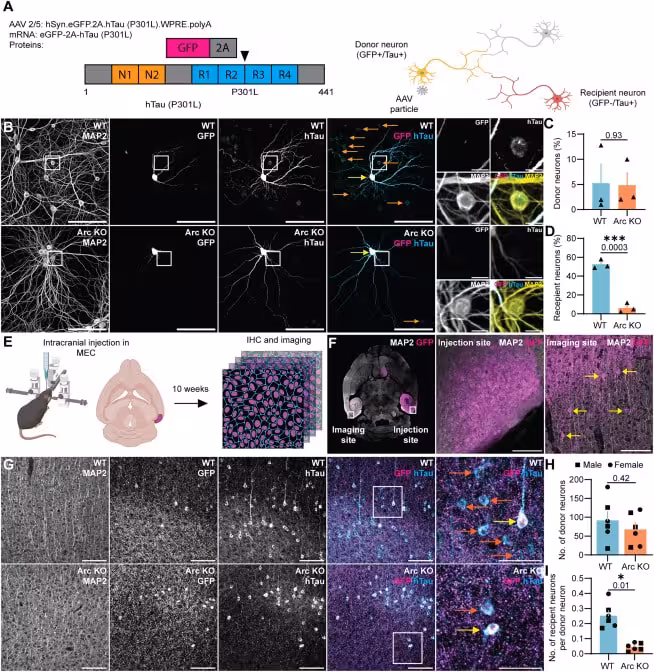 (A) Schematic of the intercellular hTau transmission assay. hSyn.eGFP-2A-2N4R-hTau(P301L) produces equal amounts of eGFP and hTau in donor neurons.
(B) Representative images of hTau and eGFP staining in WT and Arc KO hippocampal primary neurons. Neurons were sparsely transduced at DIV 7. 14 days post transduction, the neurons were fixed and immunostained for eGFP and hTau. Transduced donor neurons are indicated by yellow arrows, and recipient neurons are indicated by orange arrows. Scale bar, 100 μm (main images), 50 μm (zoomed in images).
(C) Virus transduction is similar in WT and Arc KO primary neurons. The percentage of donor neurons is not different in WT and Arc KO neurons, indicating comparable viral transduction (n = 3 independent cultures). See also Figure S10 for transduction at DIV7.
(D) Intercellular hTau transmission is reduced in Arc KO primary neurons. The percentage of recipient neurons is significantly reduced in Arc KO neurons (n = 3 independent cultures).
(E) Schematic for the in vivo tau transmission assay. For in vivo studies, 6-month-old WT and Arc KO mice were injected with the hSyn-eGFP-2A-2N4R hTau(P301L) virus unilaterally in the medial entorhinal cortex. 10 weeks post-injection, the brains were collected, sectioned, and immunostained for eGFP and hTau. Imaging was performed in the contralateral media entorhinal cortex.
(F) Representative images showing injection and imaging sites. Yellow arrows indicate donor neurons at the imaging site. Sparse transduction in the contralateral entorhinal cortex allows hTau transmission to be quantified. Scale bar, 100 μm.
(G) Representative images of hTau and eGFP staining in WT and Arc KO entorhinal cortex. Transduced donor neurons are indicated by yellow arrows, and recipient neurons are indicated by orange arrows. Scale bar, 100 μm (main images), 50 μm (zoomed in images).
(H) Virus transduction is similar in the WT and Arc KO mice’s entorhinal cortex. WT and Arc KO mice show no differences in the number of donor neurons, indicating comparable levels of virus transduction in WT and Arc KO mice (n = 6, 3M, 3F).
(I) Intercellular hTau transmission is reduced in Arc KO mice in vivo. The number of recipient neurons per donor neuron is reduced in Arc KO mice, indicating reduced intercellular hTau transmission (n = 6, 3M, 3F). Data are represented as the mean ± SEM. ∗p ≤ 0.05, ∗∗∗p ≤ 0.001 using an unpaired t test (C, D, H, and I). See also Figure S11 for electrophysiological analysis of Arc KO neurons.