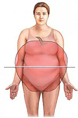 truncal obesity