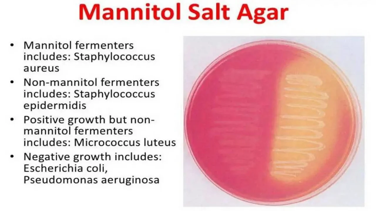 Mannitol Salt Agar.