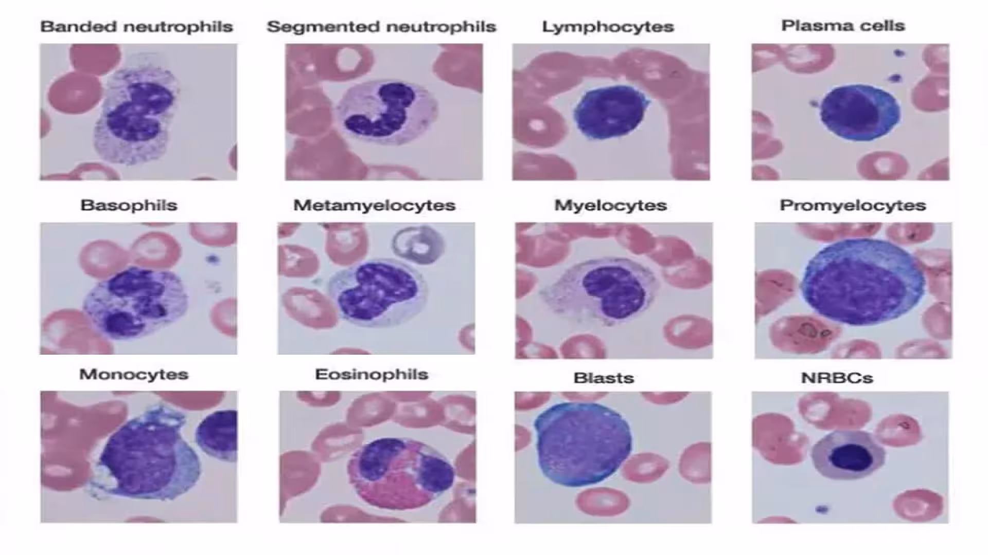 Different Types of Leukocytes