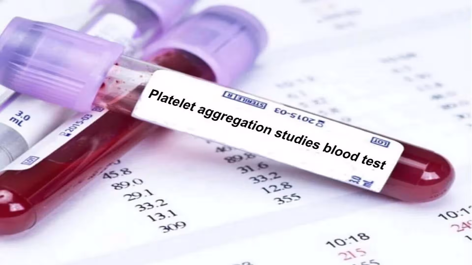 Platelet Function Test