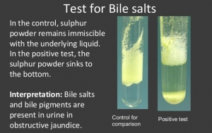 TEST FOR DETECTION OF BILE SALTS IN URINE