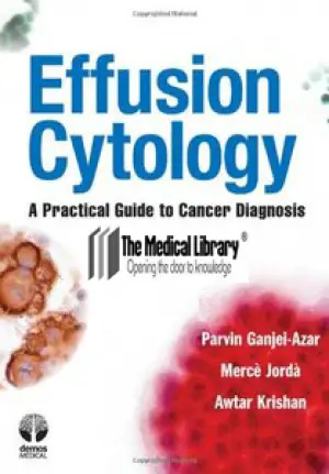 Effusion Cytology: A Practical Guide to Cancer Diagnosis