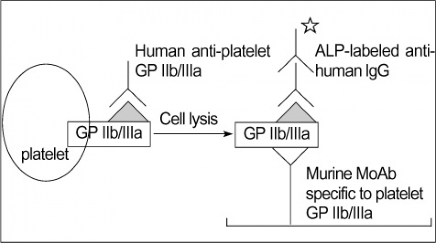 Detection of platelet specific IgG antibodies to platelet glycoproteins (GP) IIb/IIIa, Ia/IIa, Ib/IX, IV or HLA class I (GP IIb/IIIa in this example) by MACE assay. Washed platelets were first incubated with human plasma (containing anti-platelet GP IIb/IIIa in this sample). The antibody-sensitized platelets were then lysed and the supernatant was added to a microplate precoated with murine monoclonal antibodies (MoAb) specific to platelet GP or HLA class I. Any human IgG bound to the GP or HLA class I antigen were detected with a alkaline phosphatase (ALP) conjugated antihuman IgG and substrate solution.