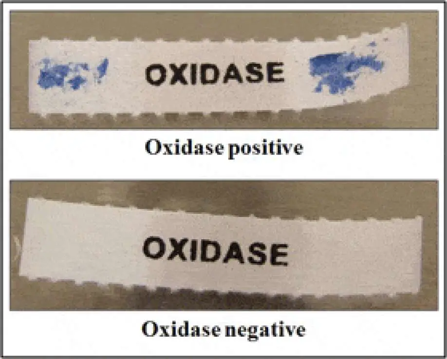Oxidase Test Results