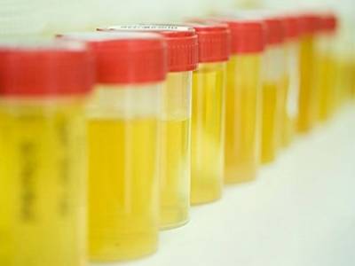 How to avoid adulteration in urine