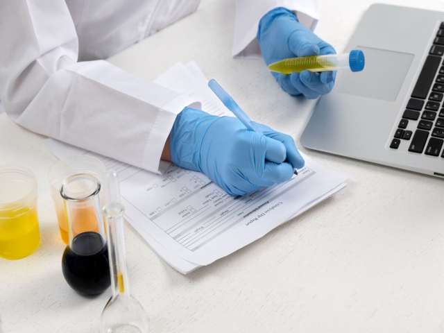 Lab doctor performing medical exam of urine.