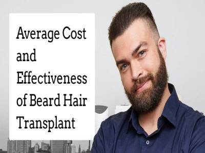Average Cost and Effectiveness of Beard Hair Transplant
