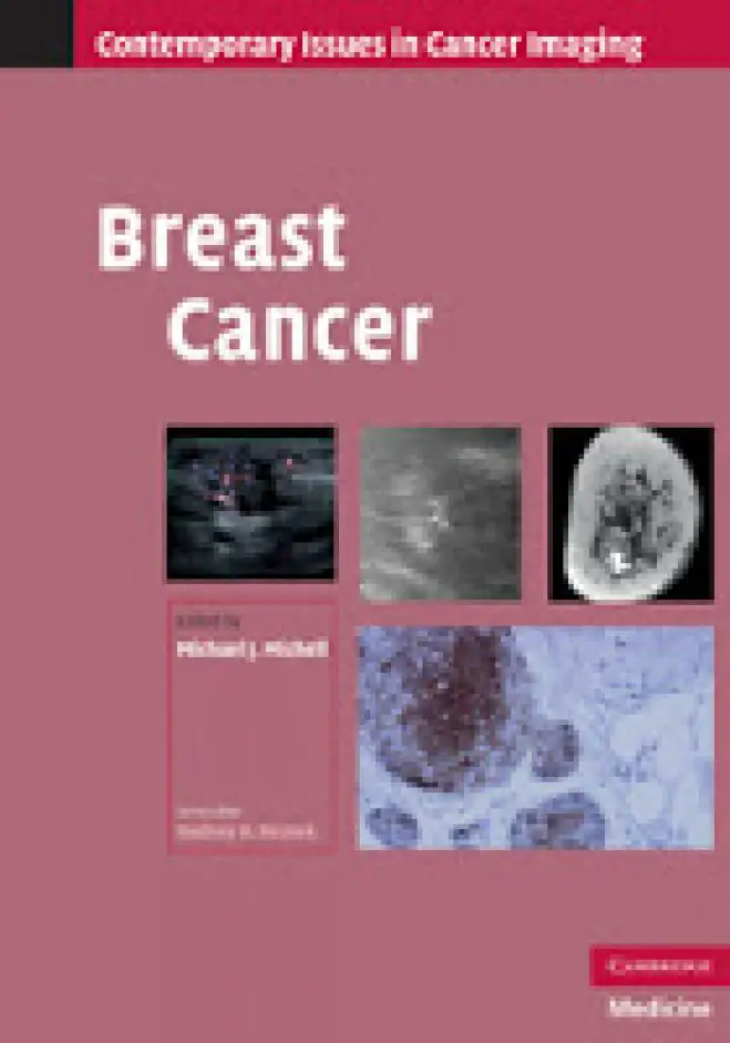 Breast Cancer - Contemporary Issues in Cancer Imaging