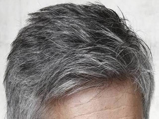 What Causes White Hair and How to Prevent it?