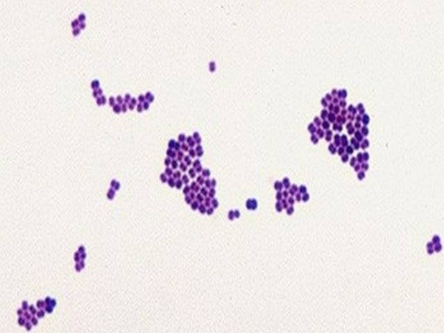 Clusters of Gram-positive bacteria