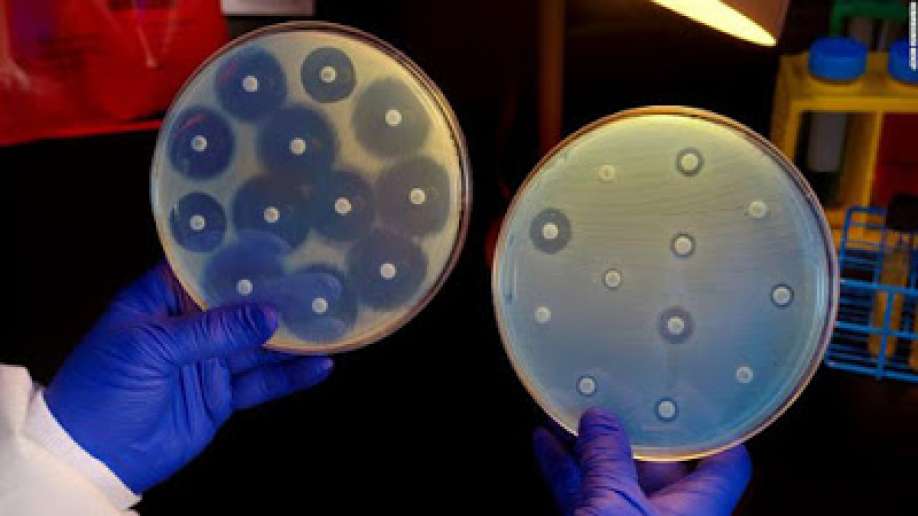 CDC sees 'steady increase' in drug-resistant bacteria